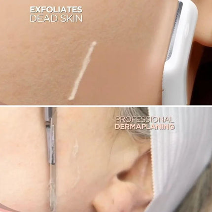 Dermaplane Gezichtshaarverwijderaar